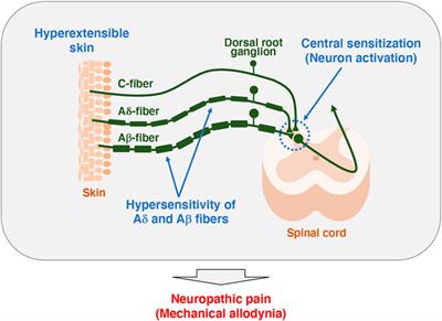 Tenascin-X as a causal gene for classical-like Ehlers-Danlos syndrome